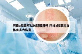 阿維a膠囊可以長期服用嗎 阿維a膠囊對身體有多大傷害