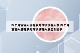 四個(gè)月寶寶頭皮有多處白塊沒有頭發(fā) 四個(gè)月寶寶頭皮有多處白塊沒有頭發(fā)怎么回事