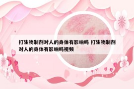 打生物制劑對人的身體有影響嗎 打生物制劑對人的身體有影響嗎視頻