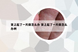 背上起了一片蘚怎么辦 背上起了一片蘚怎么辦啊