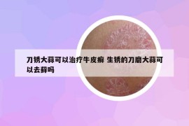 刀銹大蒜可以治療牛皮癬 生銹的刀磨大蒜可以去蘚嗎