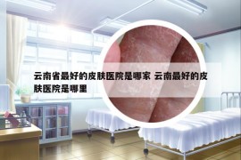 云南省最好的皮膚醫(yī)院是哪家 云南最好的皮膚醫(yī)院是哪里