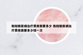衡陽銀屑病治療費用需要多少 衡陽銀屑病治療費用需要多少錢一次