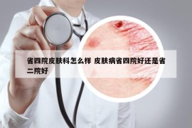 省四院皮膚科怎么樣 皮膚病省四院好還是省二院好