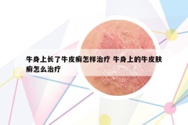 牛身上長(zhǎng)了牛皮癬怎樣治療 牛身上的牛皮膚癬怎么治療