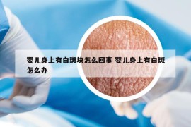 嬰兒身上有白斑塊怎么回事 嬰兒身上有白斑怎么辦