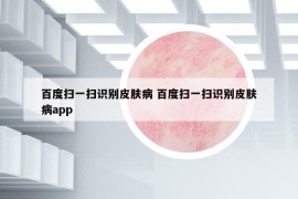 百度掃一掃識別皮膚病 百度掃一掃識別皮膚病app