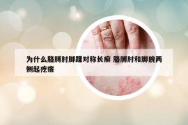 為什么胳膊肘腳踝對(duì)稱長(zhǎng)癬 胳膊肘和腳腕兩側(cè)起疙瘩