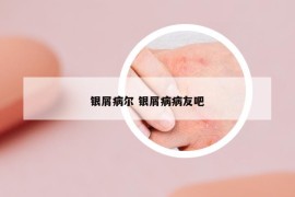 銀屑病爾 銀屑病病友吧