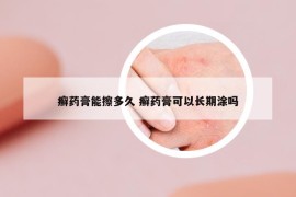 癬藥膏能擦多久 癬藥膏可以長(zhǎng)期涂嗎