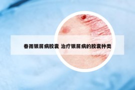 春雨銀屑病膠囊 治療銀屑病的膠囊種類