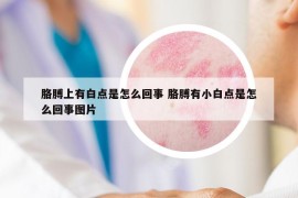 胳膊上有白點是怎么回事 胳膊有小白點是怎么回事圖片