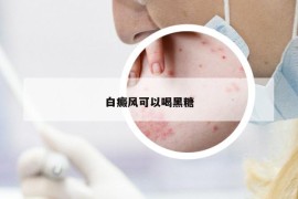 白癜風(fēng)可以喝黑糖