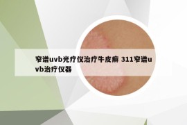窄譜uvb光療儀治療牛皮癬 311窄譜uvb治療儀器