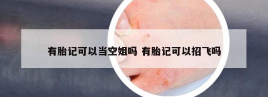 有胎記可以當(dāng)空姐嗎 有胎記可以招飛嗎