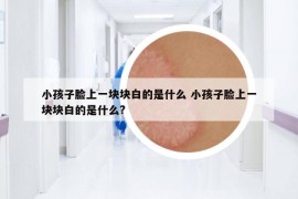 小孩子臉上一塊塊白的是什么 小孩子臉上一塊塊白的是什么?