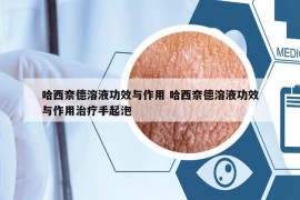 哈西奈德溶液功效與作用 哈西奈德溶液功效與作用治療手起泡