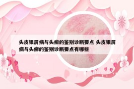 頭皮銀屑病與頭癬的鑒別診斷要點 頭皮銀屑病與頭癬的鑒別診斷要點有哪些
