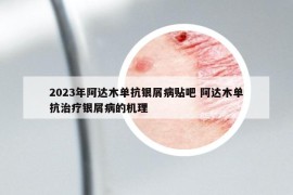 2023年阿達(dá)木單抗銀屑病貼吧 阿達(dá)木單抗治療銀屑病的機(jī)理