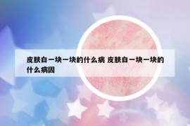 皮膚白一塊一塊的什么病 皮膚白一塊一塊的什么病因