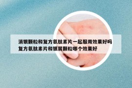 消銀顆粒和復(fù)方氨肽素片一起服用效果好嗎 復(fù)方氨肽素片和銀屑顆粒哪個(gè)效果好