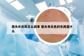 眉頭長白斑怎么回事 眉頭有白色的東西是什么