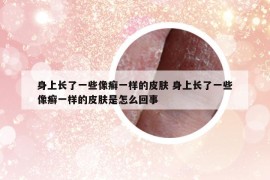 身上長了一些像癬一樣的皮膚 身上長了一些像癬一樣的皮膚是怎么回事