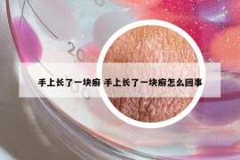 手上長了一塊癬 手上長了一塊癬怎么回事