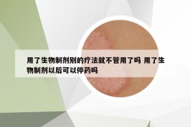 用了生物制劑別的療法就不管用了嗎 用了生物制劑以后可以停藥嗎