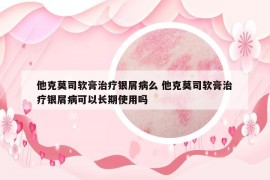 他克莫司軟膏治療銀屑病么 他克莫司軟膏治療銀屑病可以長期使用嗎
