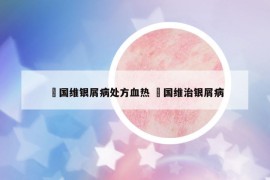 禤國維銀屑病處方血熱 禤國維治銀屑病