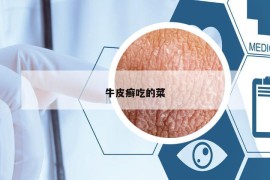 牛皮癬吃的菜