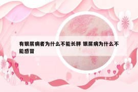 有銀屑病者為什么不能長(zhǎng)胖 銀屑病為什么不能感冒