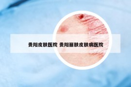 貴陽(yáng)皮膚醫(yī)院 貴陽(yáng)麗膚皮膚病醫(yī)院