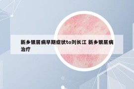新鄉(xiāng)銀屑病早期癥狀to劉長(zhǎng)江 新鄉(xiāng)銀屑病治療