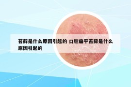 苔蘚是什么原因引起的 口腔扁平苔蘚是什么原因引起的