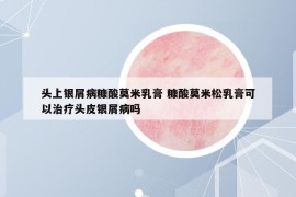 頭上銀屑病糠酸莫米乳膏 糠酸莫米松乳膏可以治療頭皮銀屑病嗎