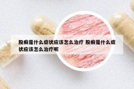 股癬是什么癥狀應(yīng)該怎么治療 股癬是什么癥狀應(yīng)該怎么治療呢