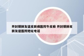 開封朝鮮友誼皮膚病醫(yī)院牛皮癬 開封朝鮮皮膚友誼醫(yī)院地址電話