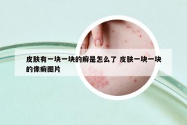 皮膚有一塊一塊的癬是怎么了 皮膚一塊一塊的像癬圖片