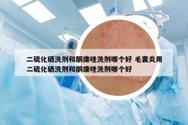 二硫化硒洗劑和酮康唑洗劑哪個(gè)好 毛囊炎用二硫化硒洗劑和酮康唑洗劑哪個(gè)好