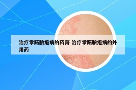 治療掌跖膿皰病的藥膏 治療掌跖膿皰病的外用藥