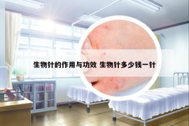 生物針的作用與功效 生物針多少錢(qián)一針