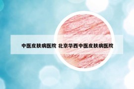 中醫(yī)皮膚病醫(yī)院 北京華西中醫(yī)皮膚病醫(yī)院