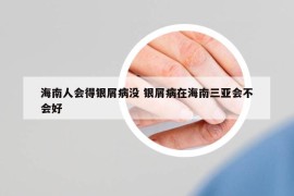 海南人會得銀屑病沒 銀屑病在海南三亞會不會好