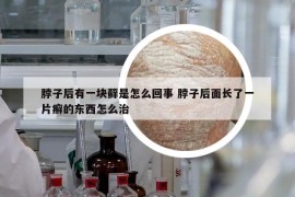 脖子后有一塊蘚是怎么回事 脖子后面長了一片癬的東西怎么治