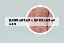 百癬夏塔熱膠囊的功效 百癬夏塔熱膠囊的功效主治