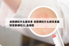 皮膚病吃什么維生素 皮膚病吃什么維生素最好皮膚病吃21,金維他