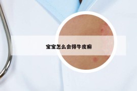 寶寶怎么會得牛皮癬