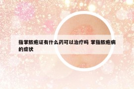 指掌膿皰證有什么藥可以治療嗎 掌指膿皰病的癥狀